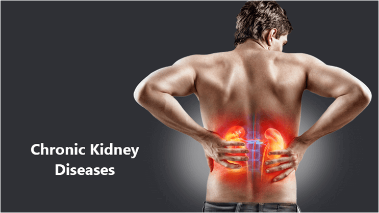 Kidney disease treatment